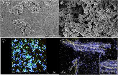 Francisella tularensis subsp. holarctica wild-type is able to colonize natural aquatic ex vivo biofilms